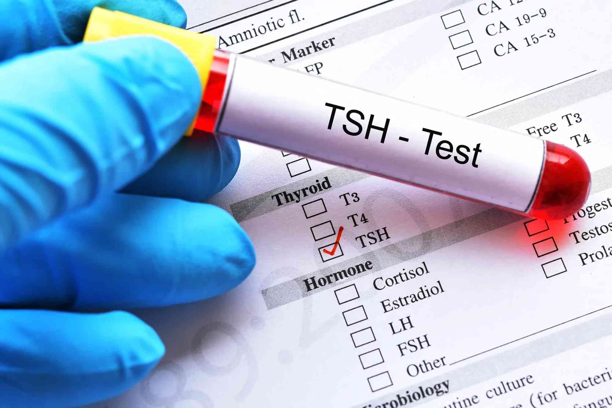 Can TSH Test Be Done After Food